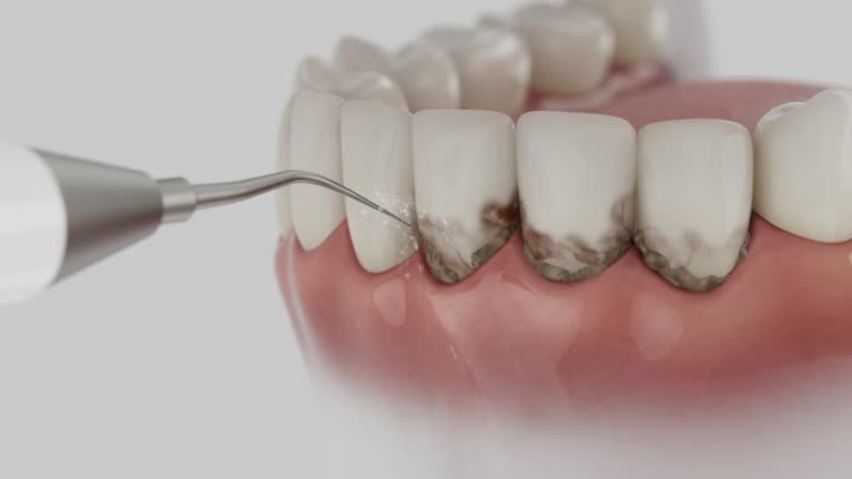 Reliable Emergency Dentist contractor in Clark County County, MO by Dentist Open Now